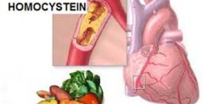 Homocysteín – utajený objav lekárskej vedy
